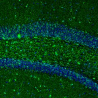 Staining of mouse dentate gyrus shows immunoreactivity in polymorph layer.