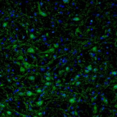 Staining of mouse motor trigeminal nucleus shows positivity in neuronal cells bodies and processes.