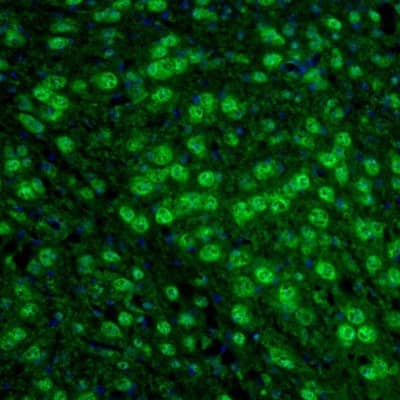 Staining of mouse thalamus shows positivity in neurons of the anterodorsal thalamic nucleus.