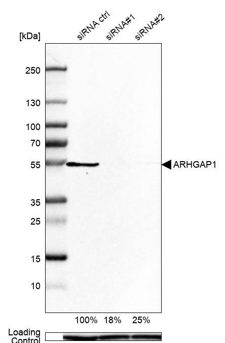 <b>Genetic Strategies Validation. </b>Analysis in U-138MG cells transfected with control siRNA, target specific siRNA probe #1 and #2, using Anti-ARHGAP1 antibody. Remaining relative intensity is presented. Loading control: Anti-GAPDH.