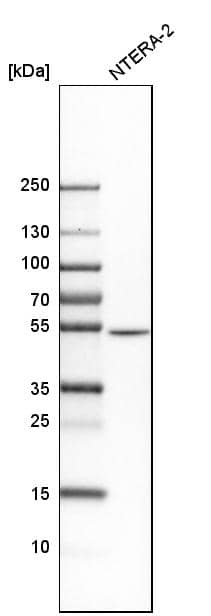 Analysis in human cell line NTERA-2.