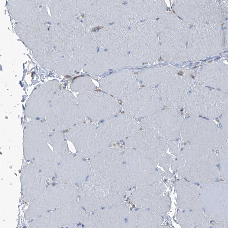 Immunohistochemistry-Paraffin Septin-7 Antibody - BSA Free