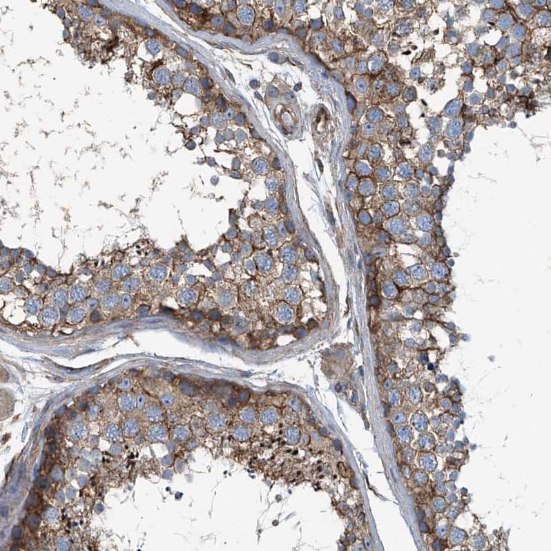 Immunohistochemistry-Paraffin Septin-7 Antibody - BSA Free