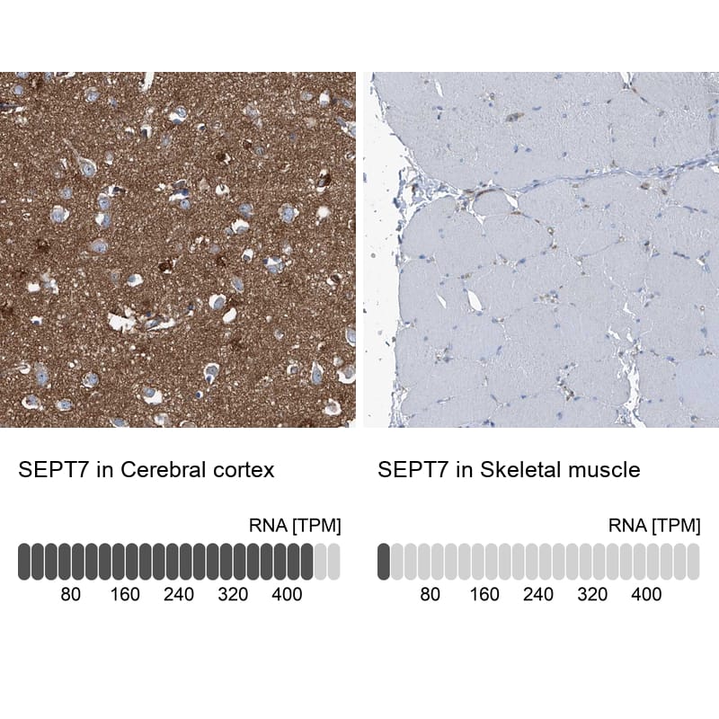 Immunohistochemistry-Paraffin Septin-7 Antibody - BSA Free