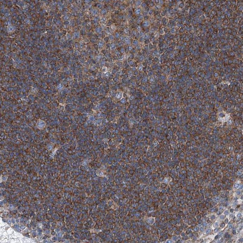 Immunohistochemistry-Paraffin Septin-7 Antibody - BSA Free