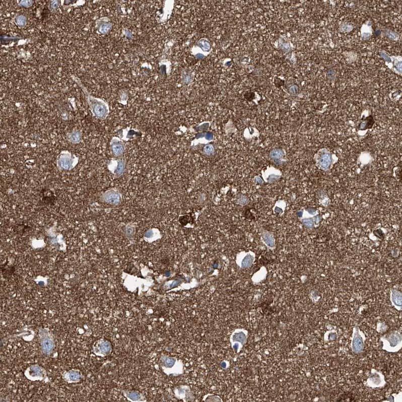 Immunohistochemistry-Paraffin Septin-7 Antibody - BSA Free
