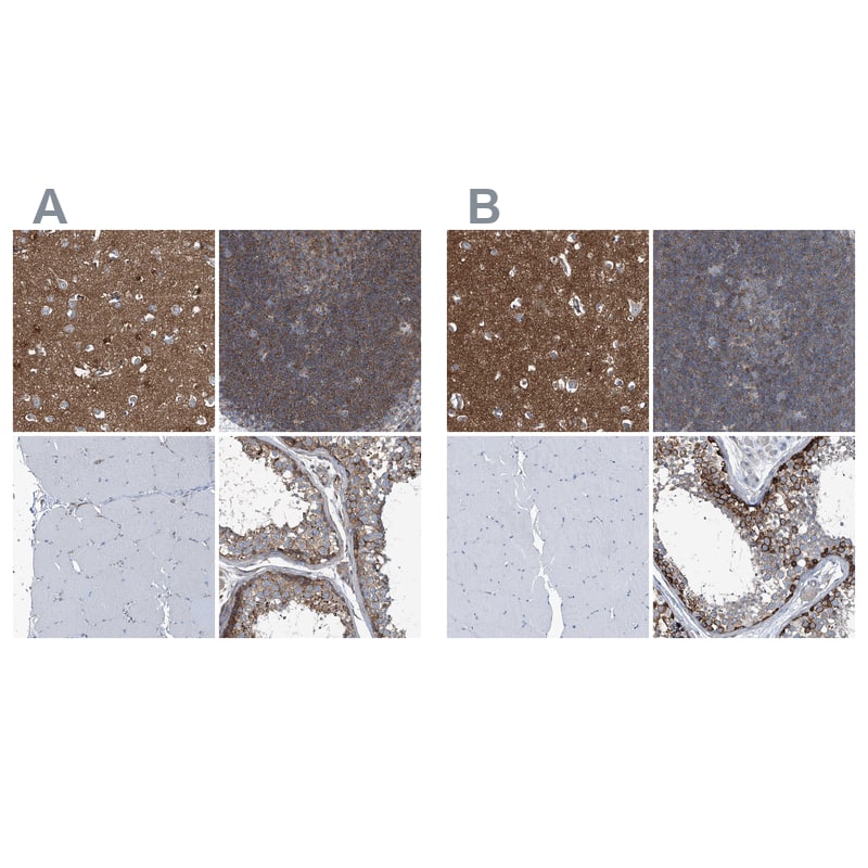 Immunohistochemistry-Paraffin Septin-7 Antibody - BSA Free