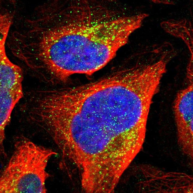 Staining of human cell line U-2 OS shows localization to vesicles.