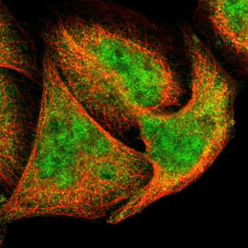 Staining of human cell line A-431 shows localization to nucleoplasm & cytosol.