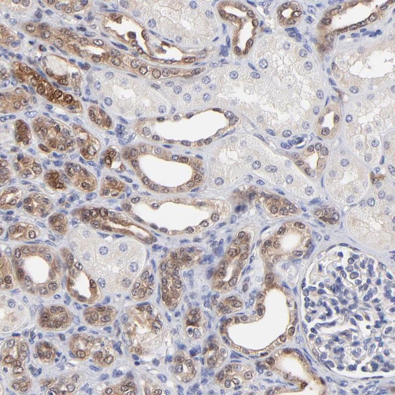 Immunohistochemistry-Paraffin XTP3TPA Antibody - BSA Free