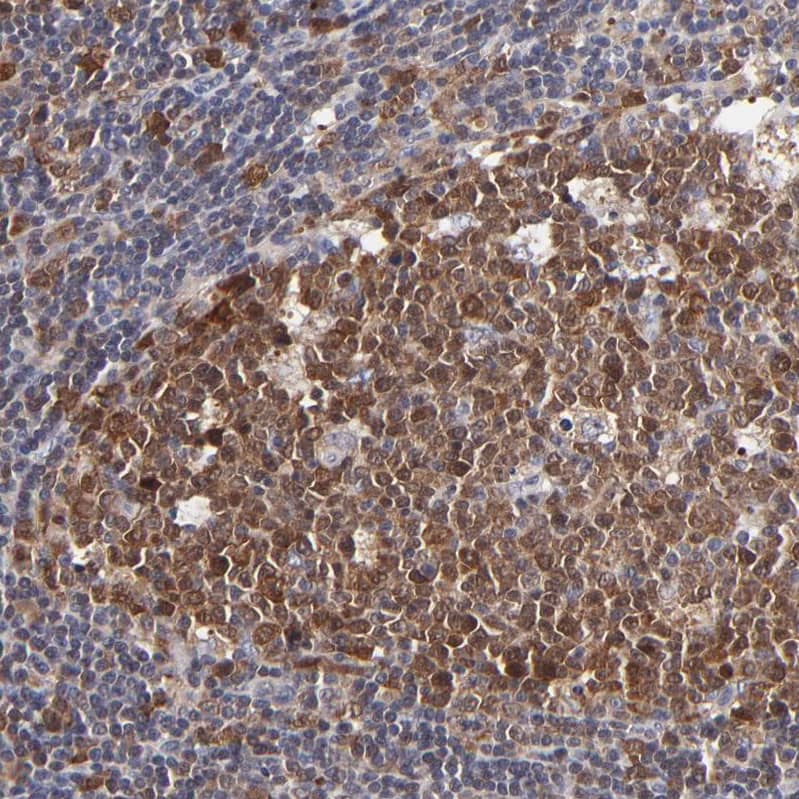 Immunohistochemistry-Paraffin XTP3TPA Antibody - BSA Free