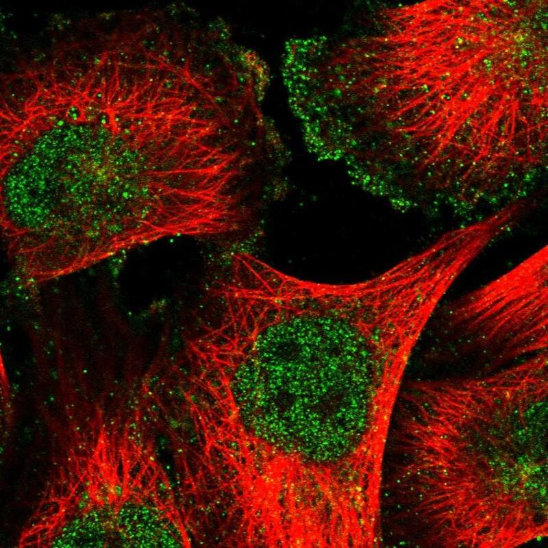 Staining of human cell line U-251 MG shows localization to nucleus & plasma membrane.