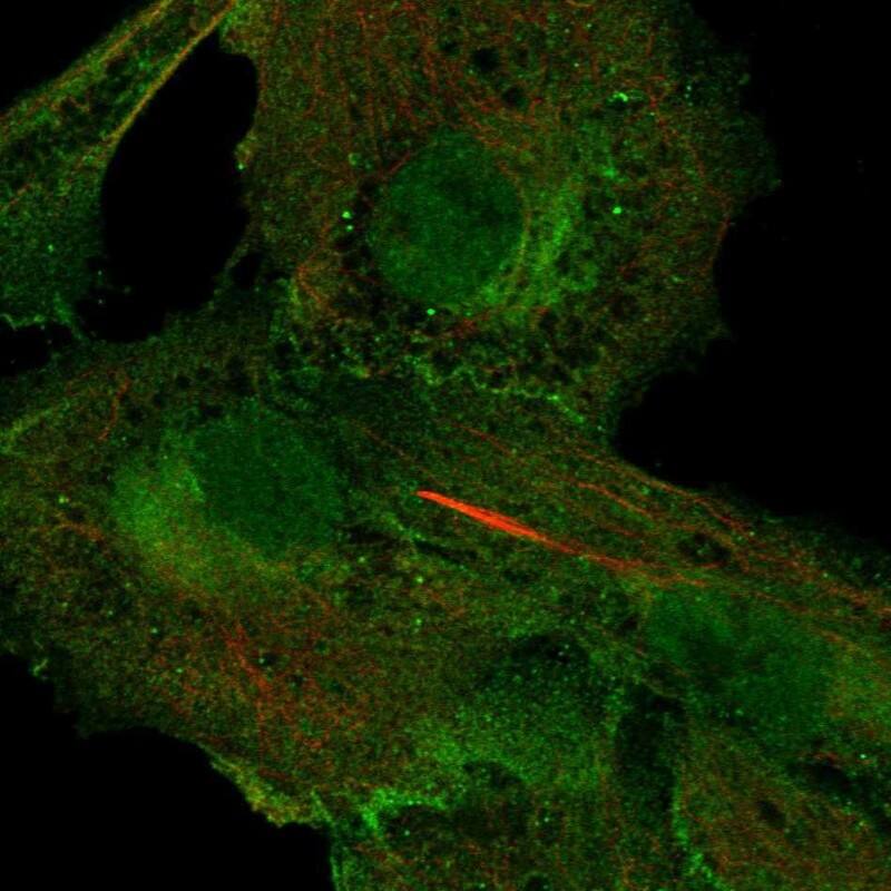 Immunocytochemistry/ Immunofluorescence 5'-Nucleotidase/CD73 Antibody - BSA Free