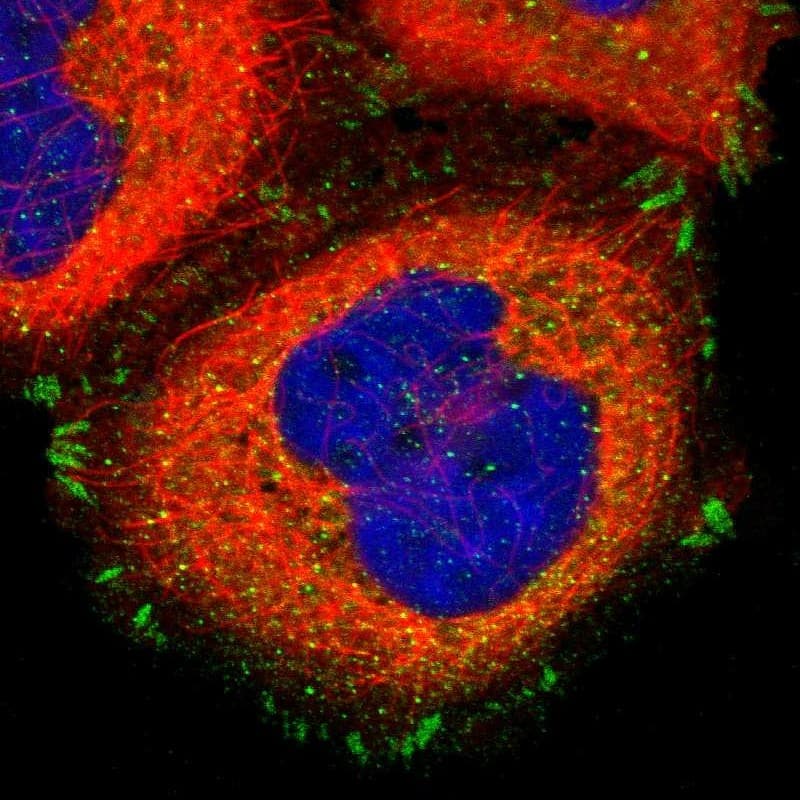 Staining of human cell line A-431 shows localization to cytosol & focal adhesion sites.