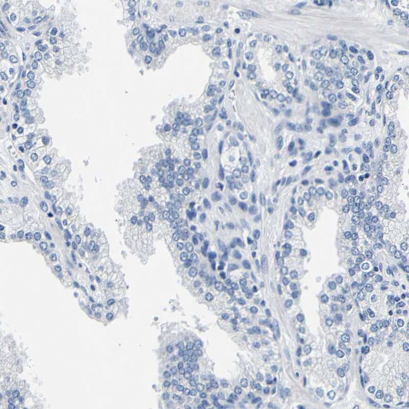 Staining of human prostate shows no positivity in glandular cells as expected.