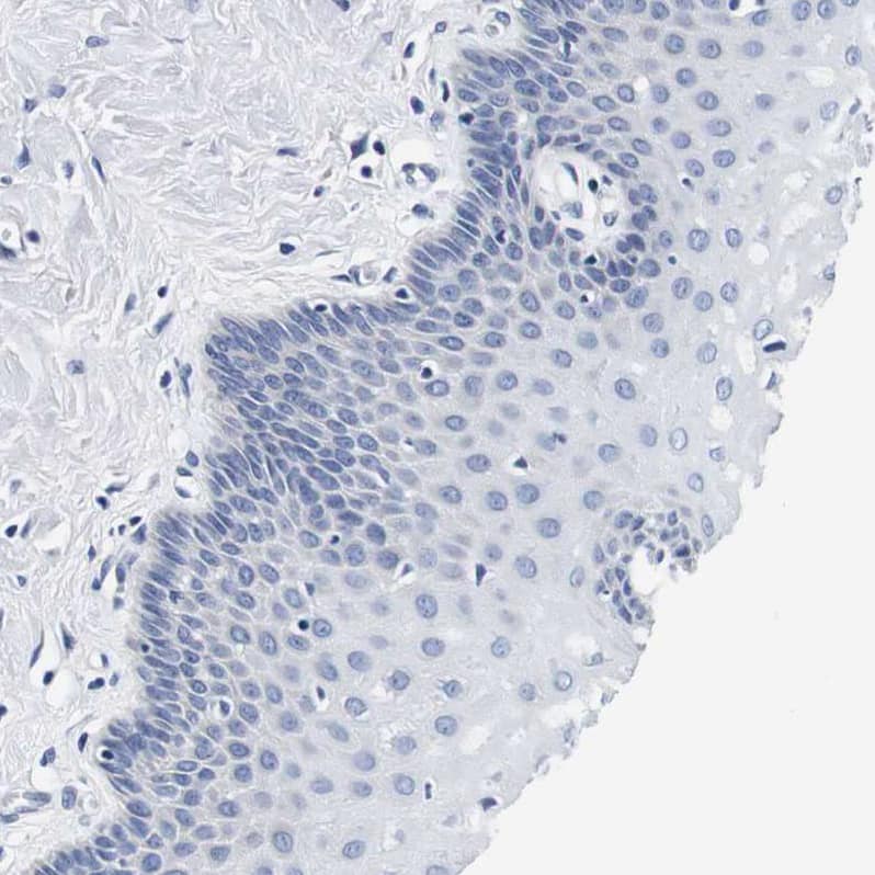 Staining of human cervix, uterine shows no positivity in squamous epithelial cells as expected.