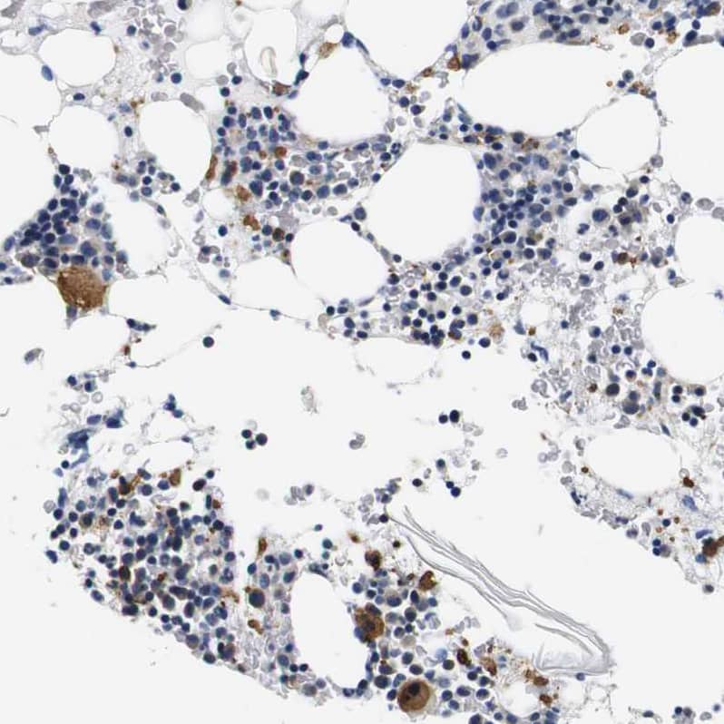 Staining of human bone marrow shows moderate positivity in megakaryocytes.