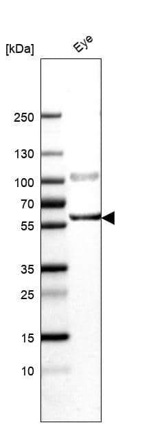 Analysis in human eye tissue.