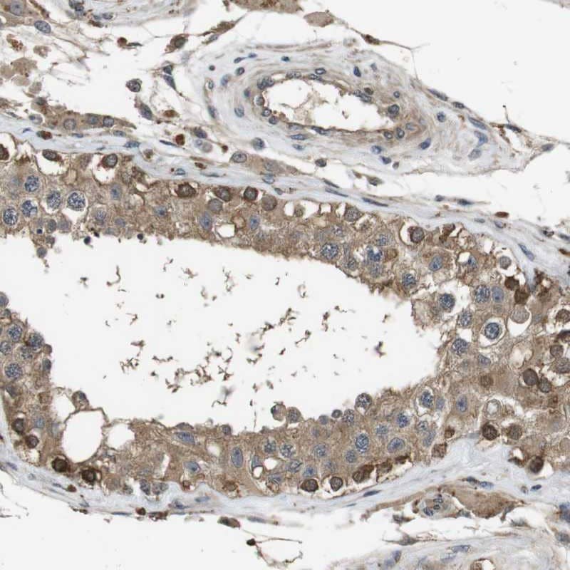 Staining of human testis shows strong cytoplasmic positivity in a subset of cells in seminiferus ducts.
