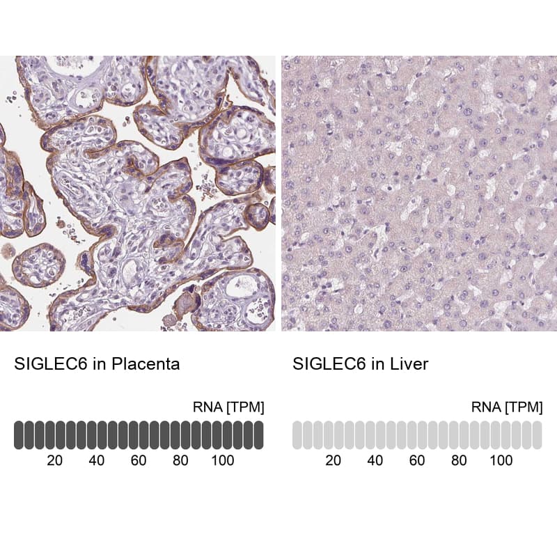 Immunohistochemistry analysis in human placenta and liver tissues using HPA018198 antibody. Corresponding SIGLEC6 RNA-seq data are presented for the same tissues.