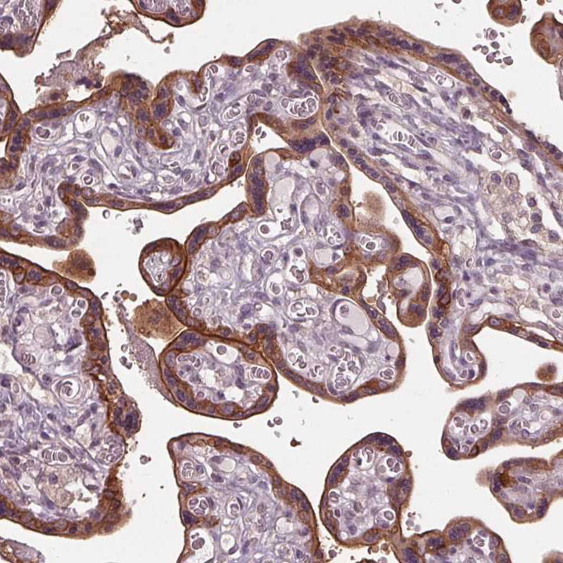 Staining of human placenta shows strong cytoplasmic and memranous positivity in trophoblastic cells.