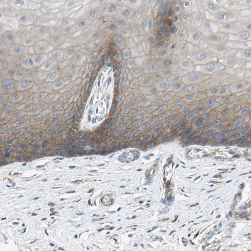 Staining of human cervix shows weak to moderate membranous positivity in squamous epithelial cells.