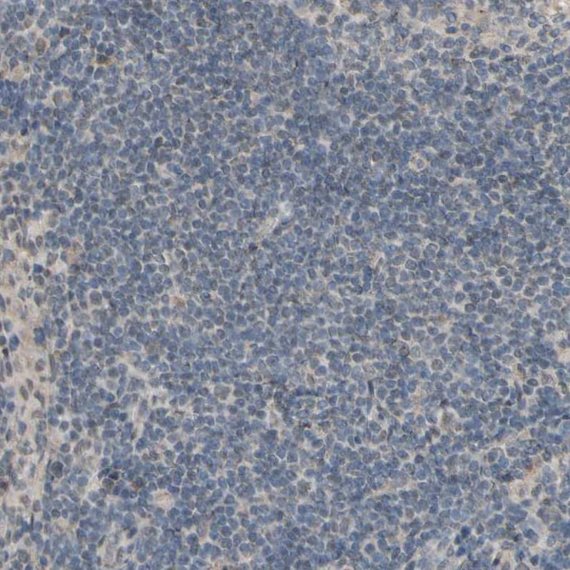 Staining of human lymph node shows low expression in non-germinal center cells as expected.