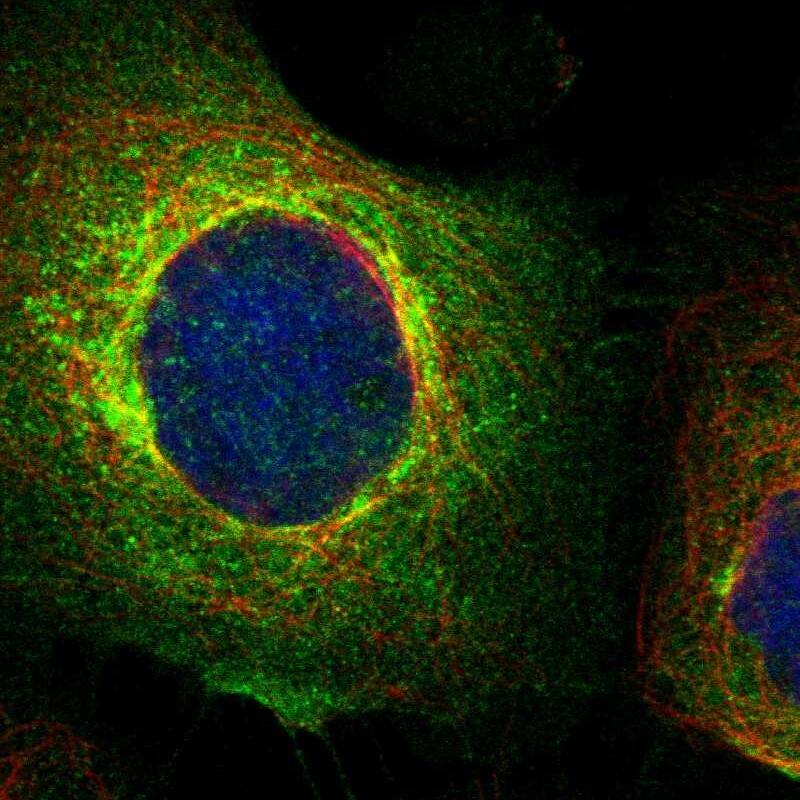 Staining of human cell line A-431 shows localization to plasma membrane, cytosol & the Golgi apparatus.