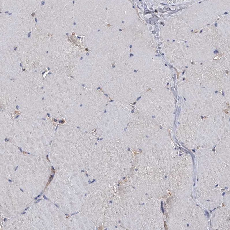 Staining of human skeletal muscle shows low positivity in myocytes as expected.