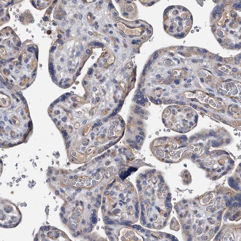Staining of human placenta shows moderate  granular cytoplasmic positivity in trophoblastic cells.