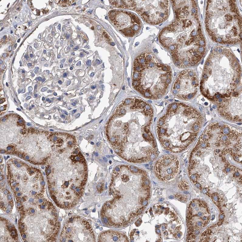 Staining of human kidney shows strong granular cytoplasmic positivity in cells in tubules.