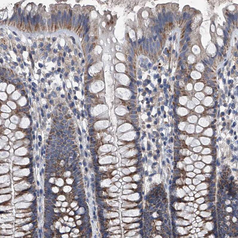 Staining of human colon shows moderate granular cytoplasmic positivity in glandular cells.