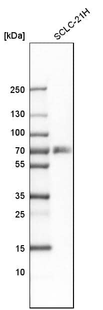 Analysis in human cell line SCLC-21H.