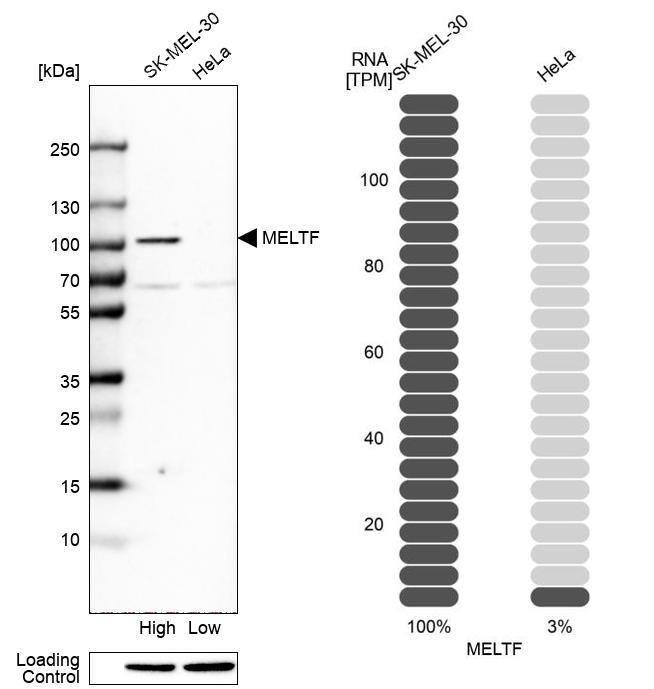 Analysis in human cell lines SK-MEL-30 and HeLa using Anti-MELTF antibody. Corresponding MELTF RNA-seq data are presented for the same cell lines. Loading control: Anti-HDAC1.