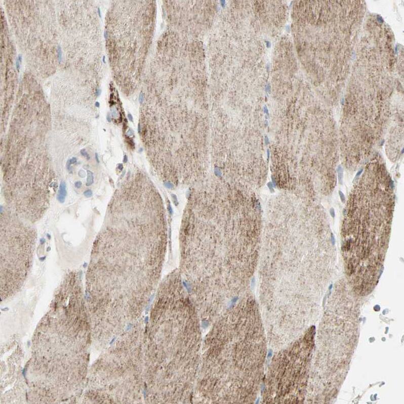 Staining of human skeletal muscle shows moderate granular cytoplasmic positivity in myocytes.