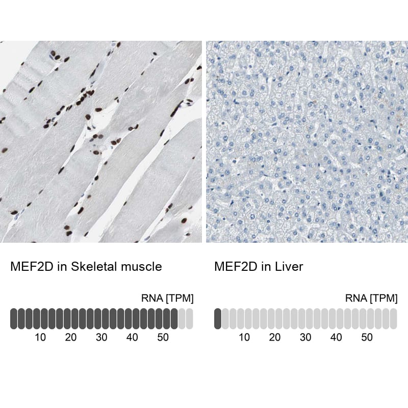 Immunohistochemistry analysis in human skeletal muscle and liver tissues using HPA007114 antibody. Corresponding MEF2D RNA-seq data are presented for the same tissues.