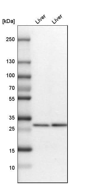Analysis in mouse liver tissue and rat liver tissue.
