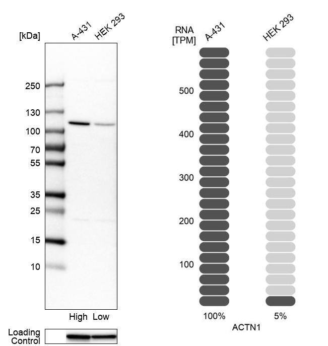 Analysis in human cell lines A-431 and HEK293 using Anti-ACTN1 antibody. Corresponding ACTN1 RNA-seq data are presented for the same cell lines. Loading control: Anti-GAPDH.