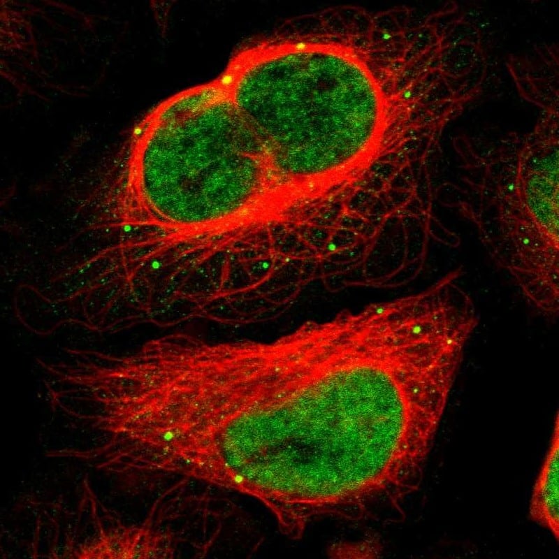 Staining of human cell line U-2 OS shows localization to nucleoplasm & vesicles.