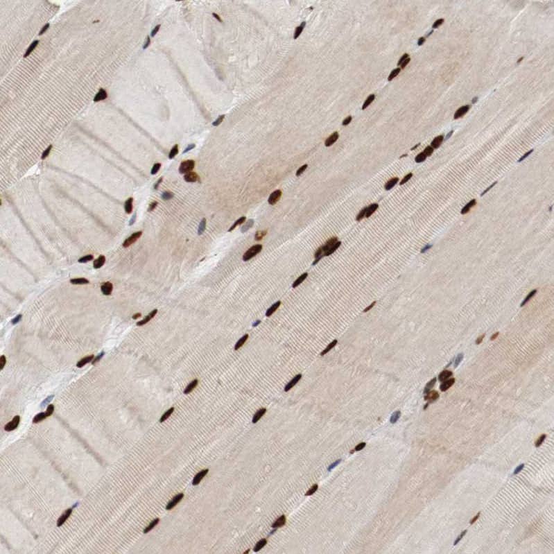 Staining of human skeletal muscle shows strong nuclear positivity in myocytes.