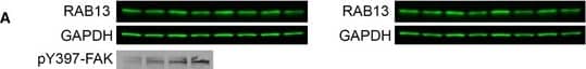 Western Blot: Rab13 Antibody [NBP1-85799] - RAB13 protein levels do not change upon serum stimulationMDA‐MB‐231 cells were stimulated with serum for the indicated times, in the presence or absence of cycloheximide (CHX). The cells were also treated with control or RAB13‐mislocalizing PMOs.Representative Western blot analysis of whole‐cell lysates & corresponding quantitations of RAB13 levels from n = 4–5 replicates. Bars: mean ± s.e.m. No significant differences by Friedman's test. Increase in pY397‐FAK levels attests to serum stimulation.RAB13 immunofluorescence at representative protrusive regions. A cell line expressing GFP was used to delineate cell borders & provide an internal cytosolic control. RAB13 signal at front lamellipodial regions was quantified. n = 35–51 protrusions. Bars: mean ± s.e.m. No increase is detected upon stimulation. By contrast, at early time points a decrease is detected (5 & 20 min, P < 0.01 by Kruskal–Wallis test), potentially arising from serum‐induced endocytosis of RAB13‐containing membranes. Scale bars: 8 μm. Image collected & cropped by CiteAb from the following publication (//pubmed.ncbi.nlm.nih.gov/32946136), licensed under a CC-BY license. Not internally tested by Novus Biologicals.