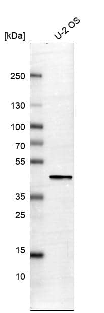 Lane 1: Marker [kDa] 220, 112, 84, 47, 32, 26, 17Lane 2: Human cell line RT-4Lane 3: Human cell line U-251MG sp