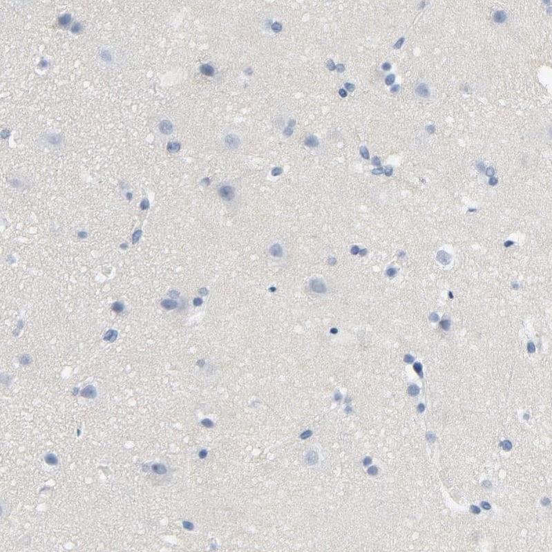 Staining of human cerebral cortex shows no positivity in neurons as expected.