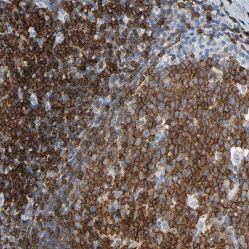 Staining of human tonsil shows strong membranous/cytoplasmic membranous positivity in non-germinal center cells and germinal center cells.