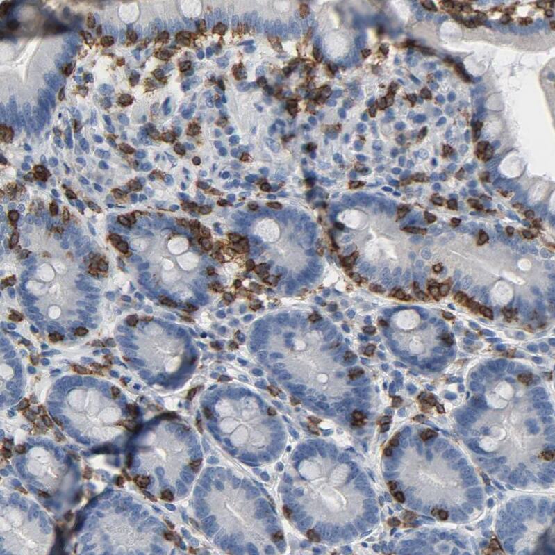 Staining of human duodenum shows strong membranous/cytoplasmic membranous positivity in lymphoid cells.