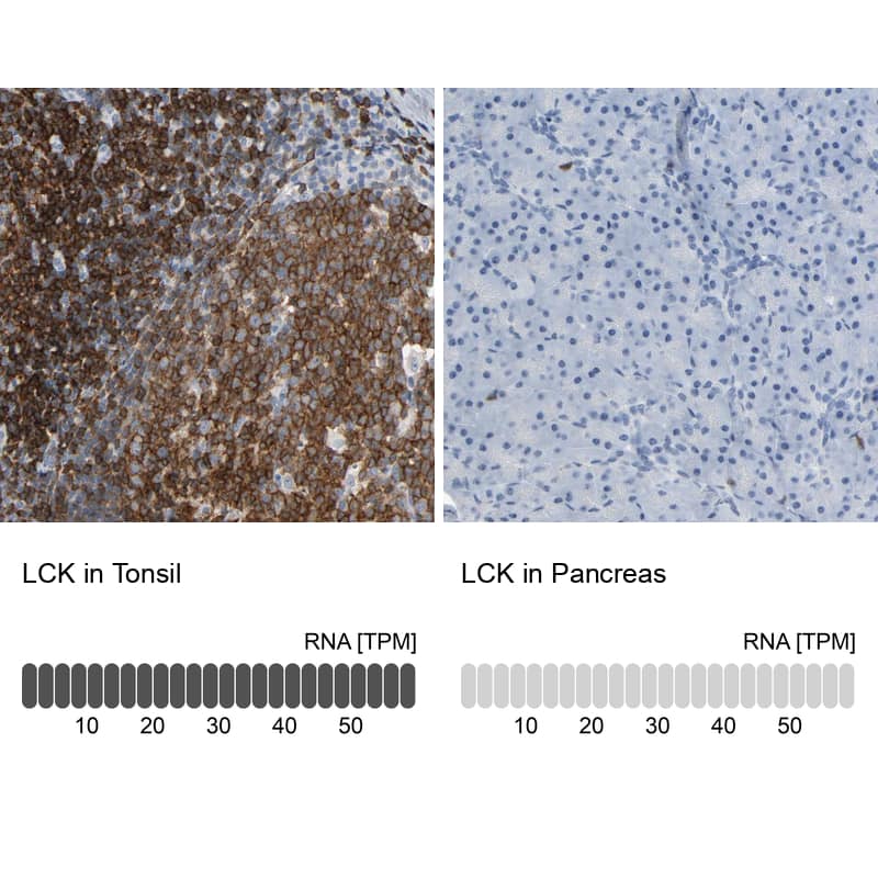 Immunohistochemistry analysis in human tonsil and pancreas tissues using HPA003494 antibody. Corresponding LCK RNA-seq data are presented for the same tissues.
