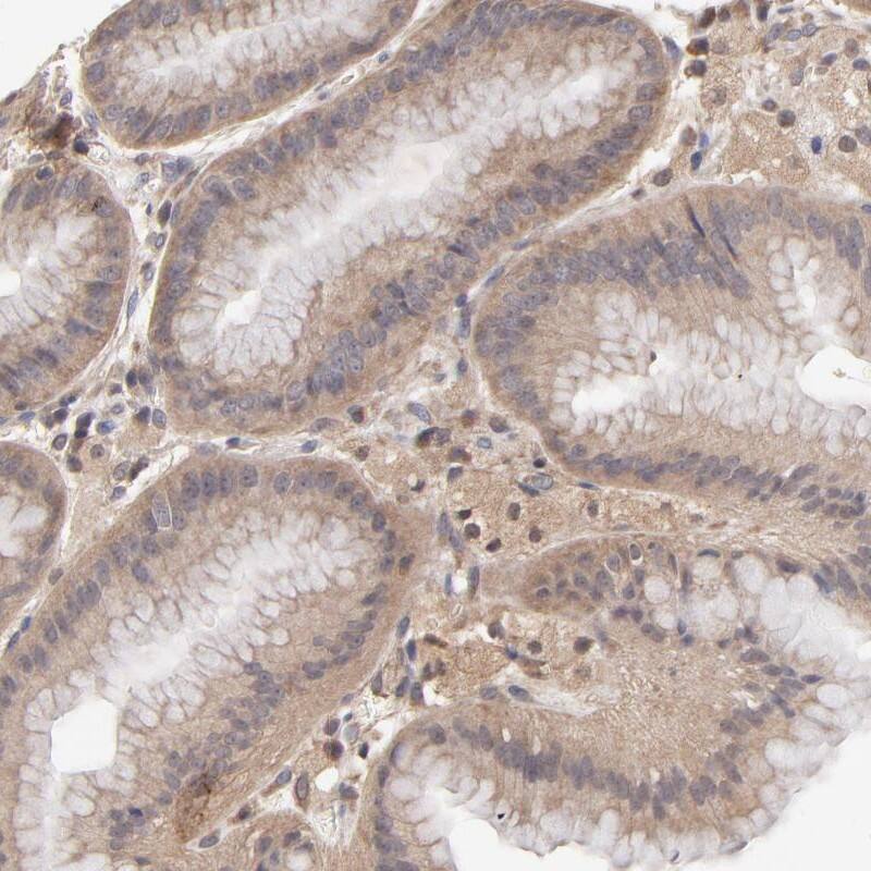 Staining of human stomach shows cytoplasmic positivity in glandular cells.
