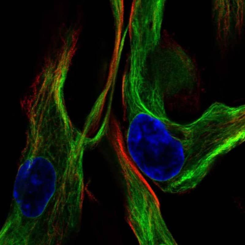 Staining of human cell line ASC TERT1 shows localization to intermediate filaments.