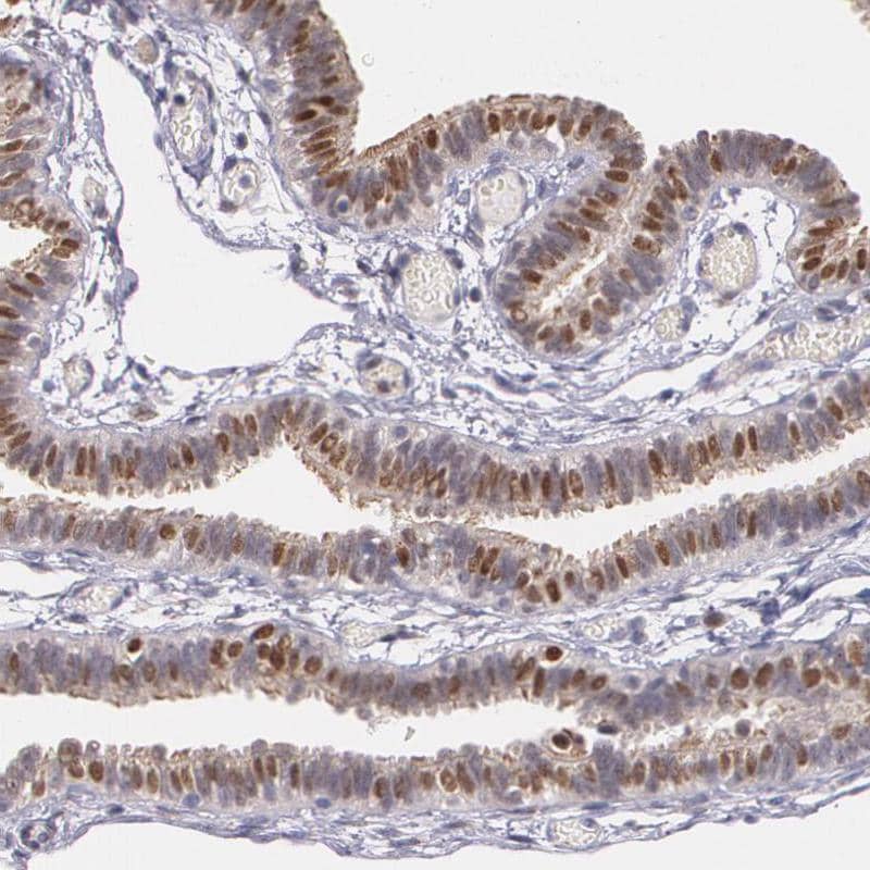 Immunohistochemistry-Paraffin ATF3 Antibody - BSA Free
