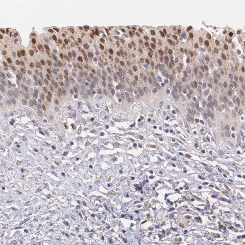 Immunohistochemistry-Paraffin ATF3 Antibody - BSA Free